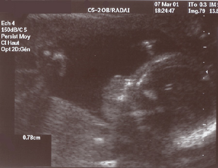 Plus de d�tails...