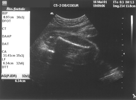 Plus de d�tails...