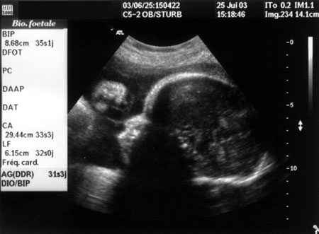 Tous les d�tails...